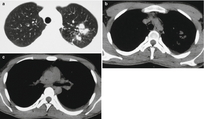 figure 23