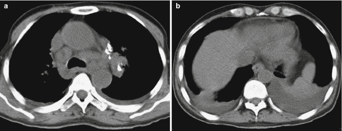 figure 24