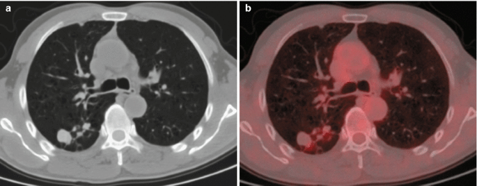 figure 28