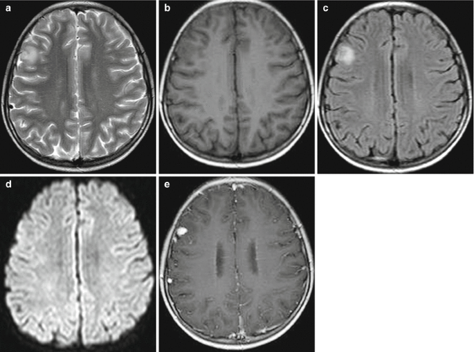 figure 30