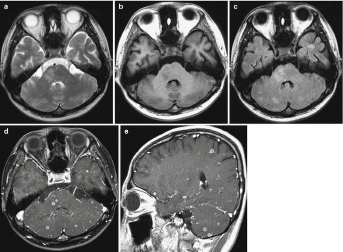 figure 32