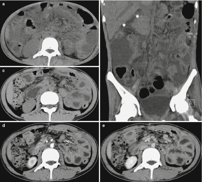 figure 34