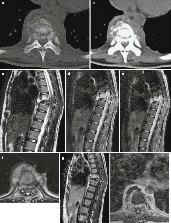 figure 37