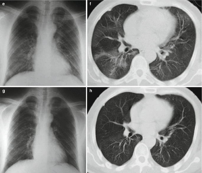 figure 23