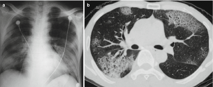 figure 25