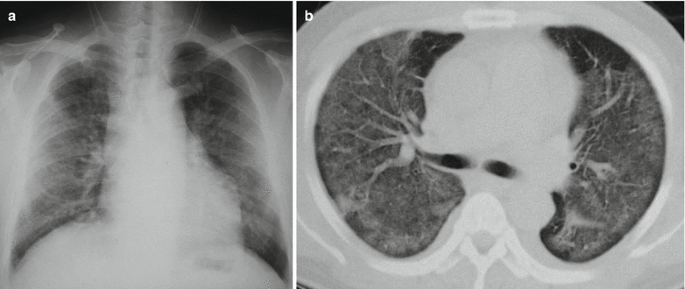 figure 26