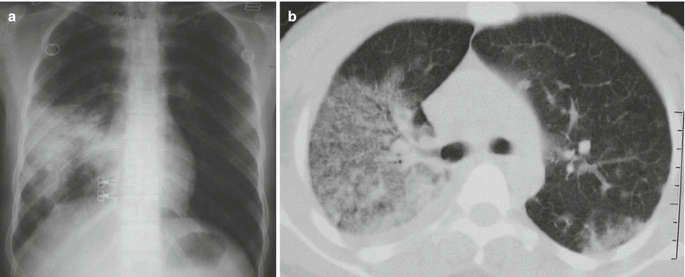 figure 27