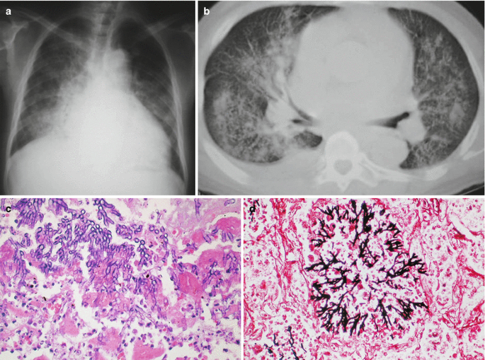 figure 29