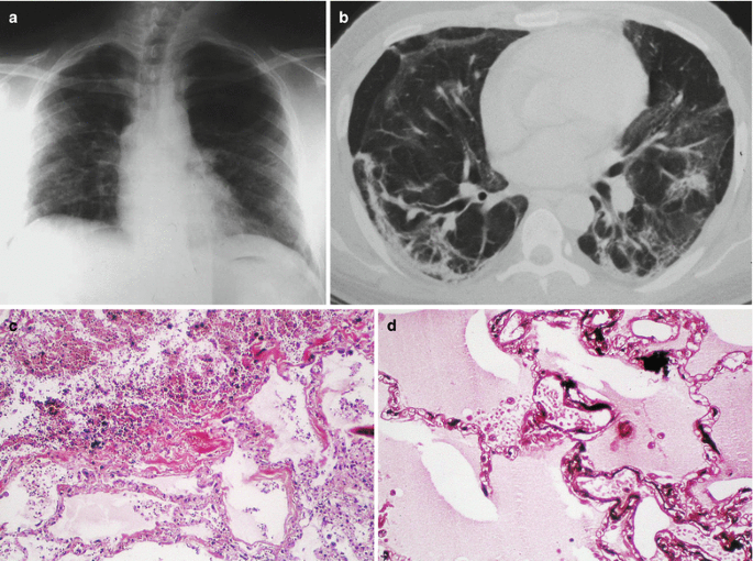 figure 30