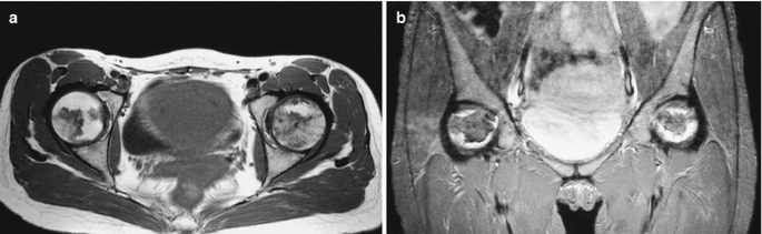 figure 32