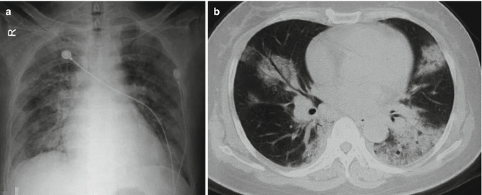 figure 33