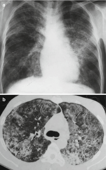 figure 36