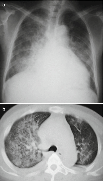 figure 38