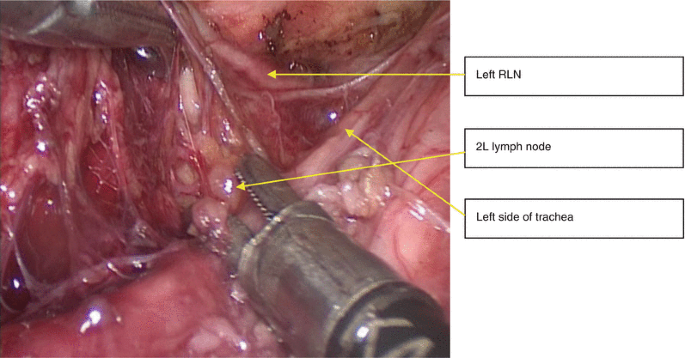 figure 62