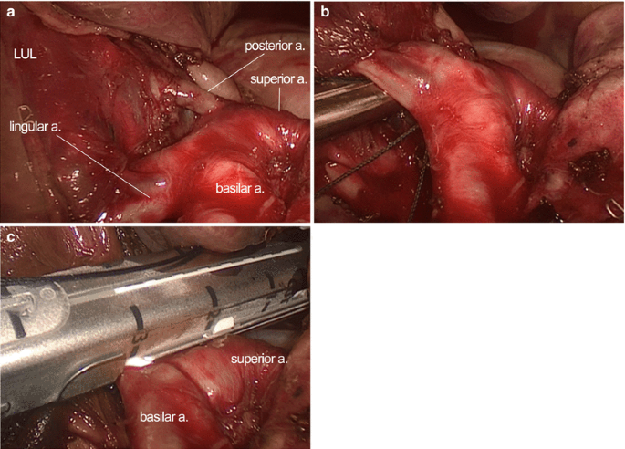 figure 33