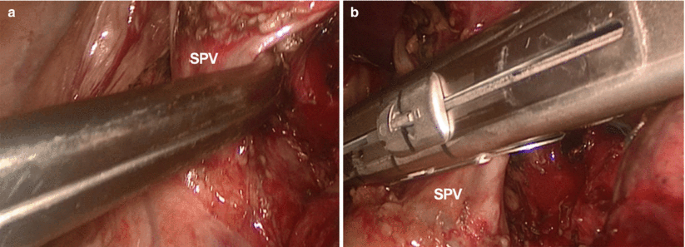 figure 34