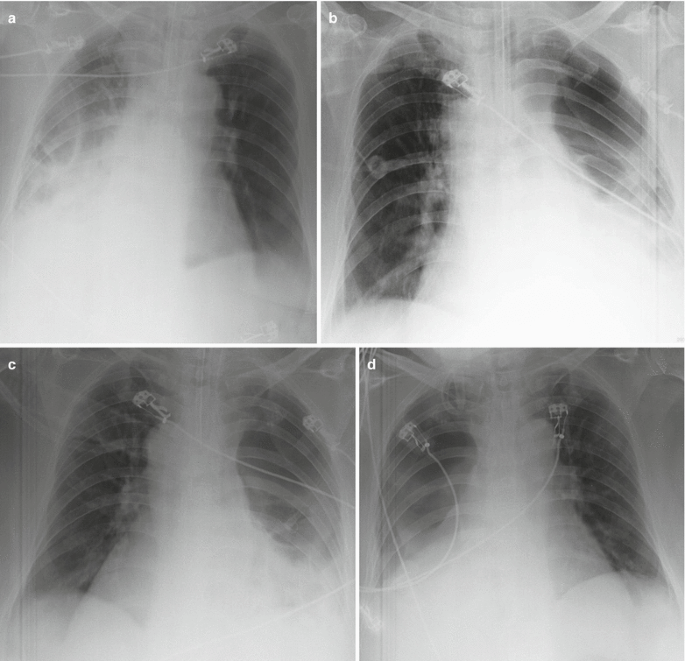 figure 23