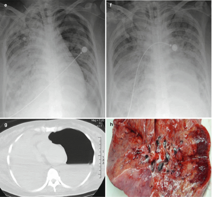 figure 24