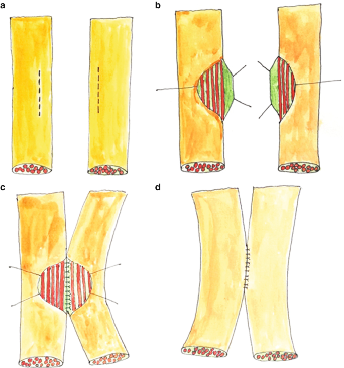 figure 21