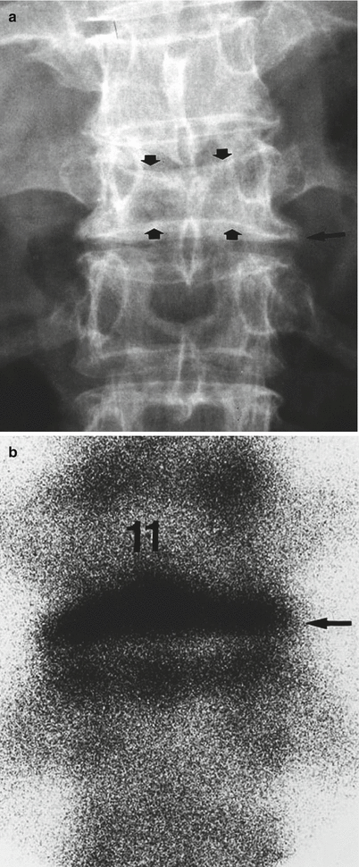 figure 24