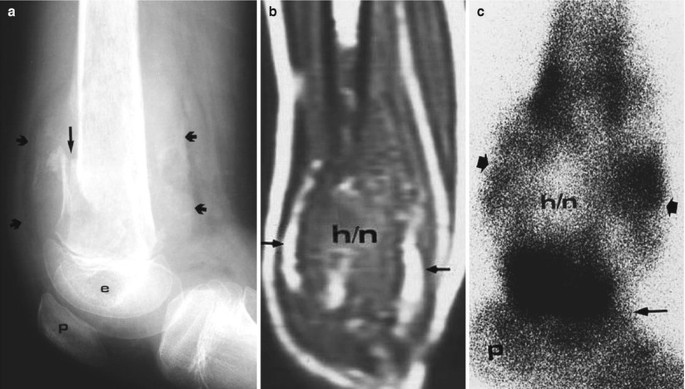 figure 44