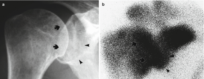 figure 24