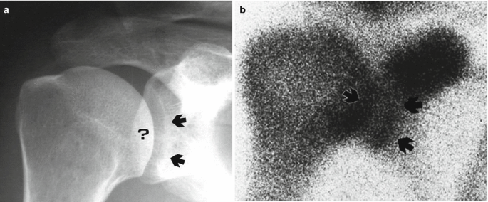 figure 27