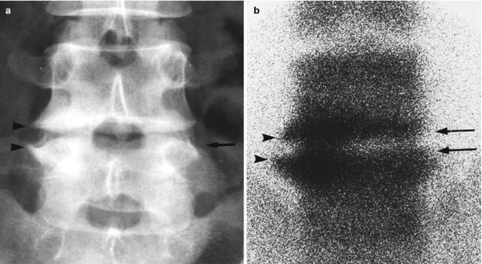 figure 37