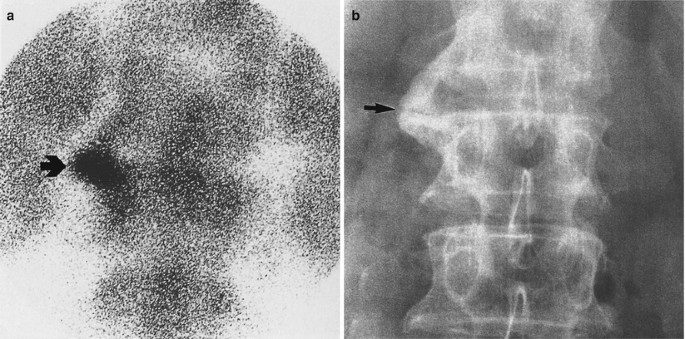 figure 40