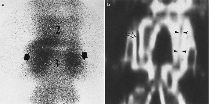 figure 42