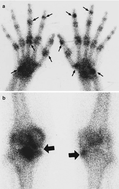 figure 53