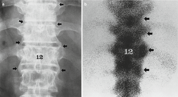 figure 54