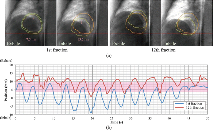 figure 32