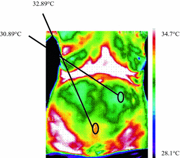 figure 22