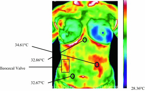 figure 23