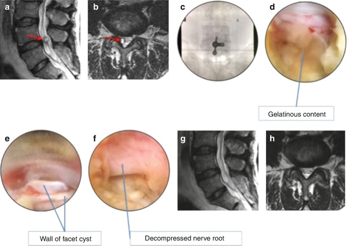 figure 30