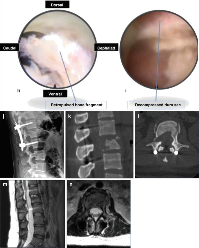 figure 33