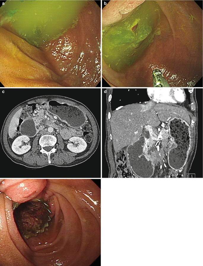 figure 44