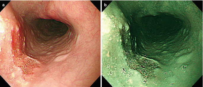 figure 27