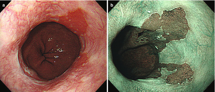 figure 39