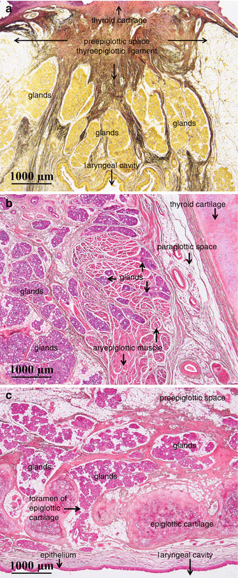 laryngeal ventricle histology