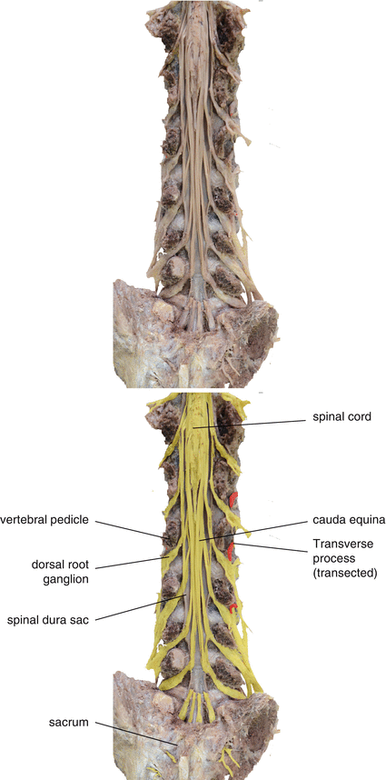 figure 33