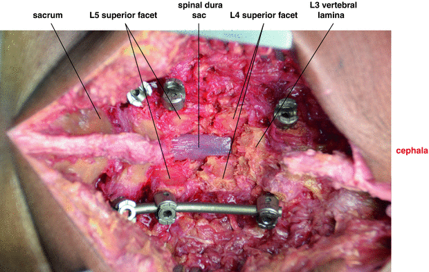 figure 59