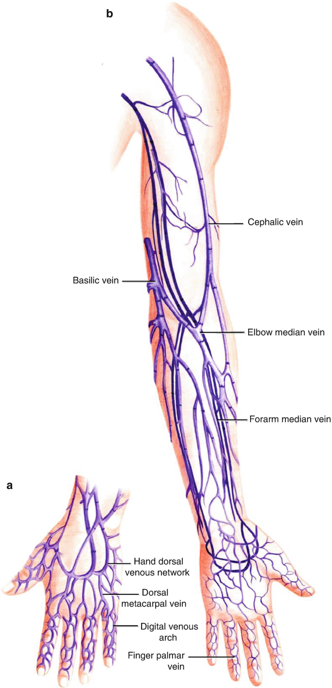 Artist drawing of the superficial and deep ulnar artery along Guyon's... |  Download Scientific Diagram