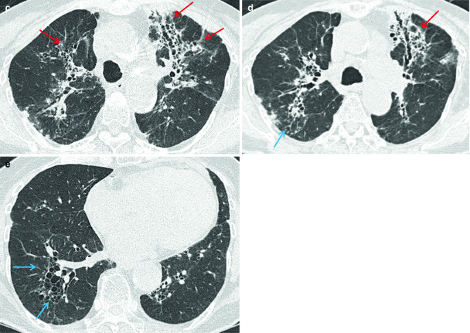 figure 15