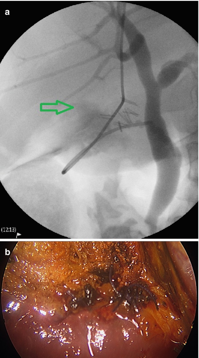 figure 31