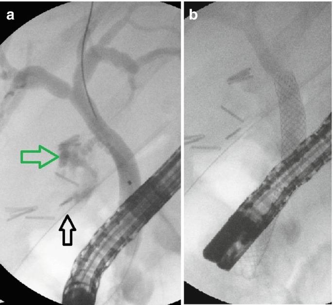 figure 33