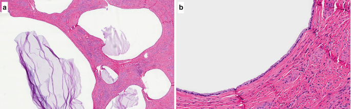 figure 26