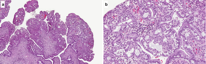 figure 32