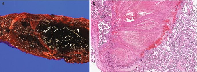 figure 39